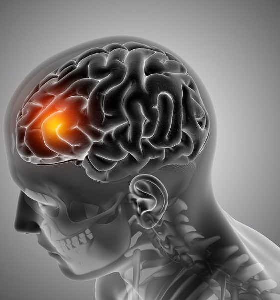 Cerebro humano