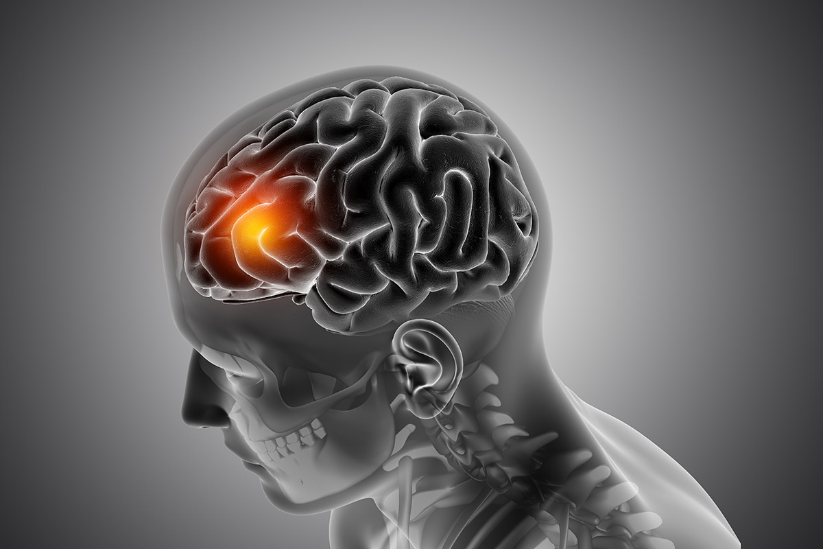 Cerebro humano